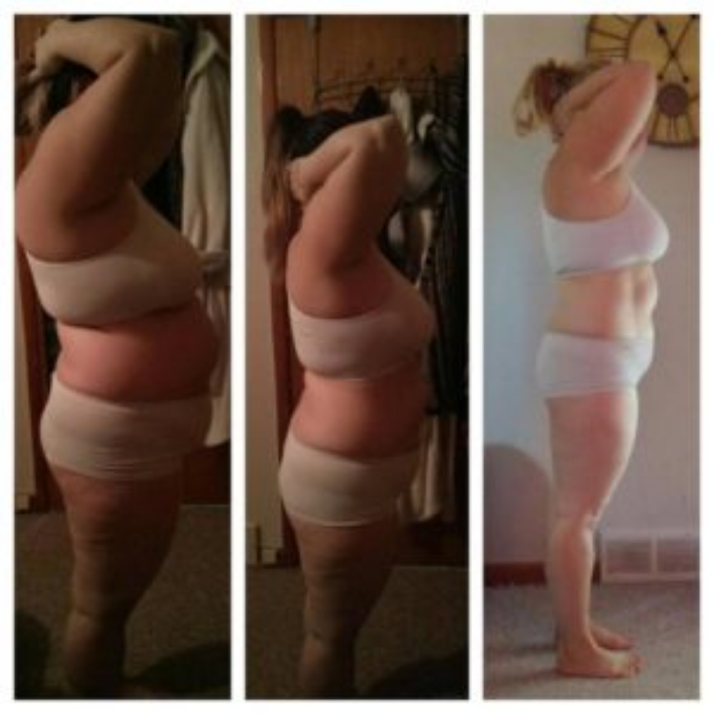 Sharon Neufeld before and after